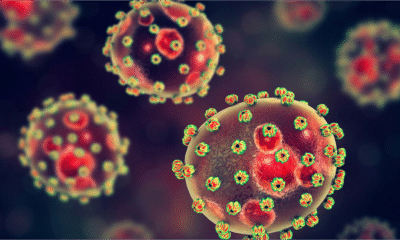 Nigeria Reports 145 Lassa Fever Deaths, 766 Cases